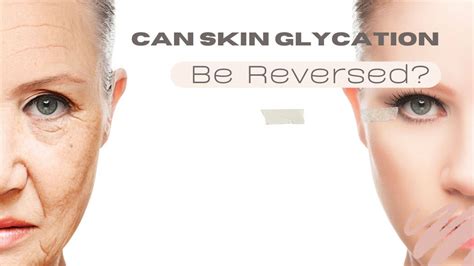 Can Skin Glycation Be Reversed The Process Of Skin Glycation Reversal