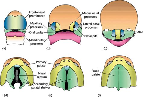 Epidemiology Of Cleft Lip And Palate Intechopen