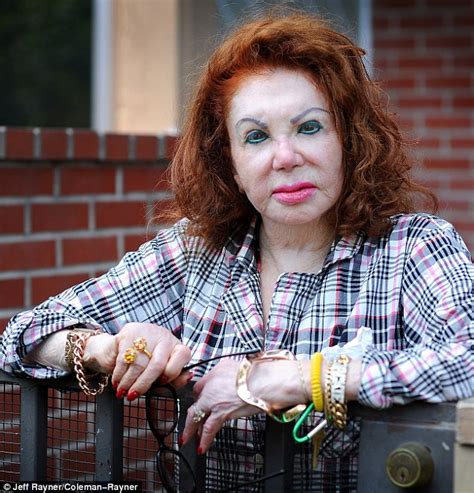 Jackie Stallone Reveals Her Plastic Surgery Regrets After Suffering A