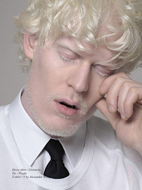 White Out Schön Magazine Stephen Thompson Bela Imperfeição Albinos