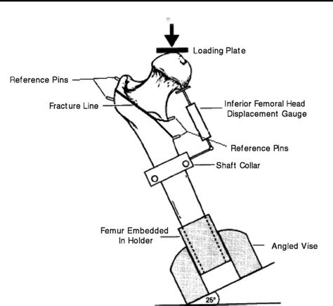 Pdf Helical Blade Versus Sliding Hip Screw For Treatment Of Unstable