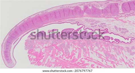 Histological Section Epiglottis Lingual Tonsil Stained Foto Stock