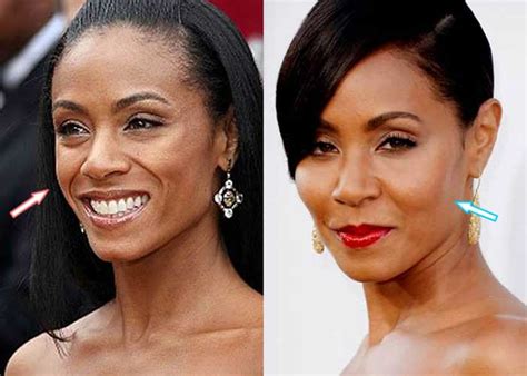 Jada Pinkett Smith Plastic Surgery Before And After Cheek Plumped And