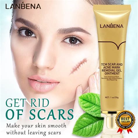 Lanbena Original Tcm Acne Scar Removal Cream Blackhead Pimple Stretch