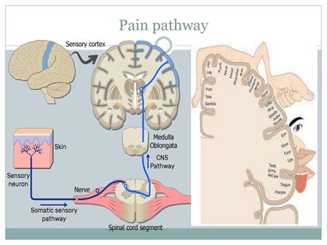 Pain Pathway Concept Maps