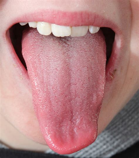 Tongue Diagnosis - Dr. Llaila Afrika