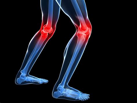 dolor de rodilla síntomas y causas más comunes martín gómez🥇