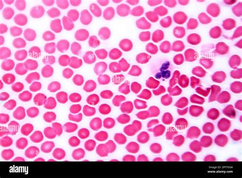 Human Blood Smear Under Microscope Light Photomicrograph Showing Red