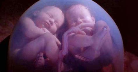 Twin Babies Caught On Mri Scan Fighting In Their Mothers Womb