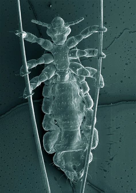 Lice Under A Microscope