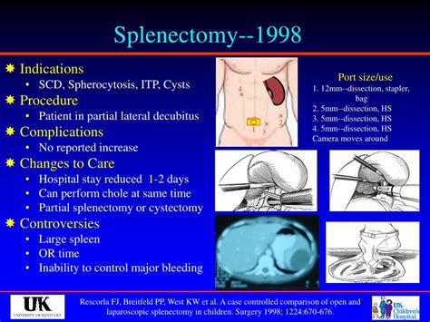 Ppt Pediatric Minimally Invasive Surgery Powerpoint Presentation Id