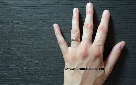 Mani Squamate Rimedi ~ Prodotto Speciale Ossigenoterapia Viso