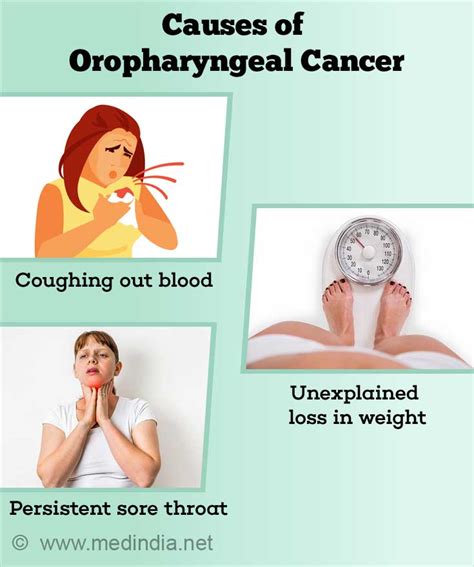 Oropharyngeal Cancer Causes Symptoms Diagnosis Treatment