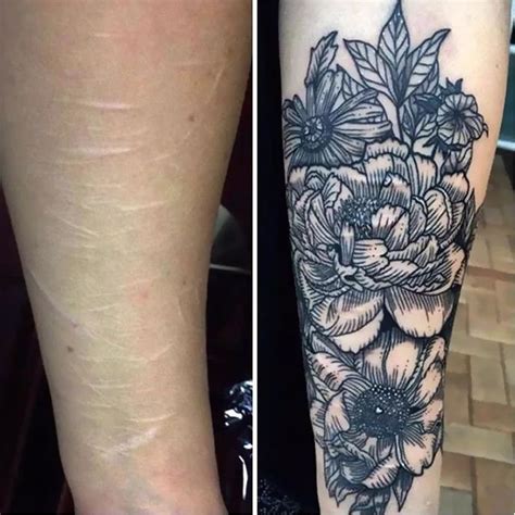 You will have to work with the scars (pattern etc.) in order to mask them, otherwise it'll still be apparent. How to Design a Tattoo That Works with Your Scars | Custom ...