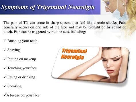 Ppt Trigeminal Neuralgia Causes Symptoms Prevention And Treatment