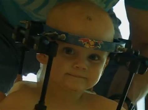 Decapitated toddler has head reattached by surgeons after car accident