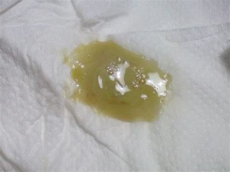 Light Green Discharge Without Odor Green Vaginal Discharge At Glance