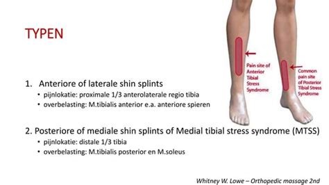 Medial Tibial Stress Syndrome Mtss