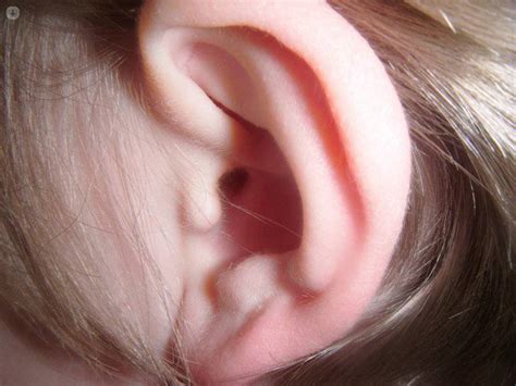 Otitis Infección Del Oído Otorrinolaringologo Manresa Top Doctors