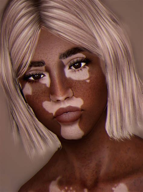 Simplykitsch As Requested The Vitiligo Skin I Made At