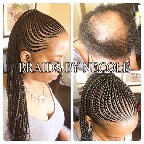 Is short hair better for balding? 14 Extraordinary Alopecia Camouflage Cornrows By Braids By ...