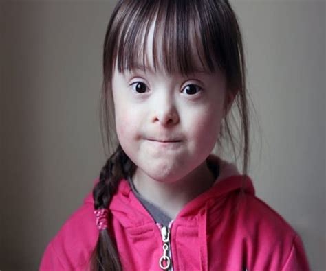 Most Families Cherish Child With Down Syndrome