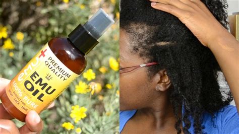 Nature's blessing has been around for years. EMU OIL FOR TRACTION ALOPECIA, BALD SPOT AND THIN EDGES ...