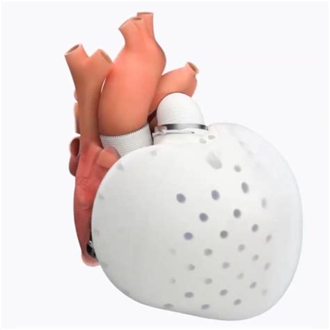 New Artificial Heart Could Help People Affected By Heart Failure Video