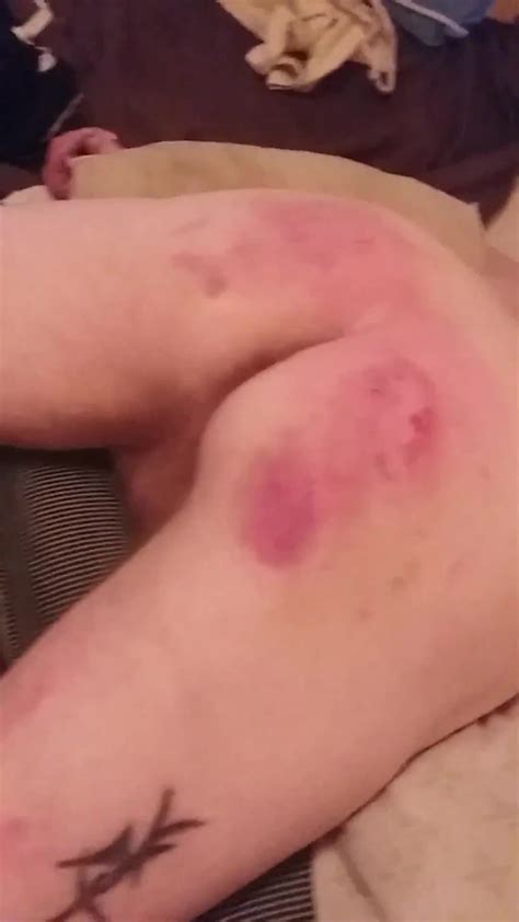 Spanked Hard By My Friend