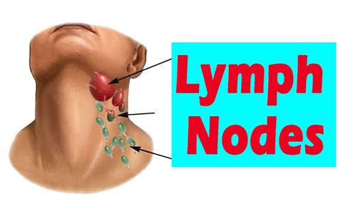 Swollen Lymph Nodes In Neck Groin Armpit Throat Under The Jaw Chin