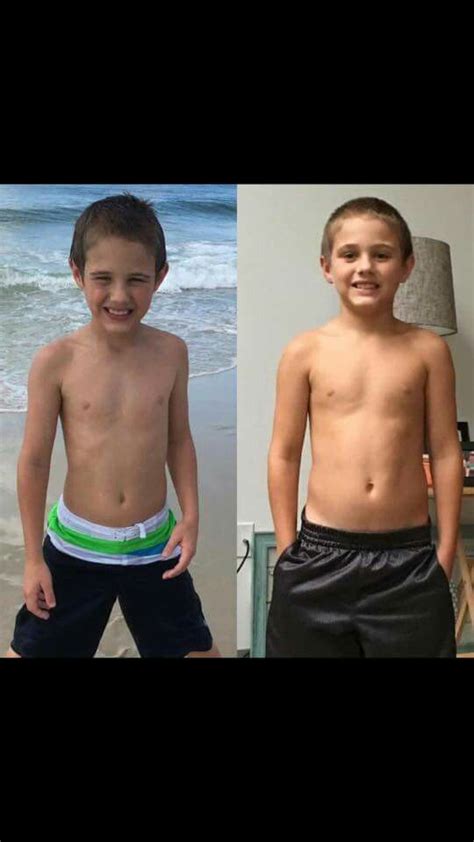 Parents, 7 ways to help your kids lose weight. Before And After Truvision Kid Truvision Swimwear Speedo