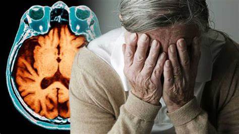 Alzheimer's Now another strategy to treat Alzheimer's