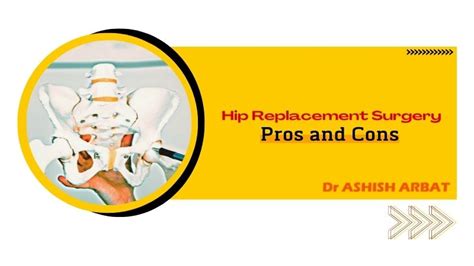 Pros And Cons Of Hip Replacement Surgery