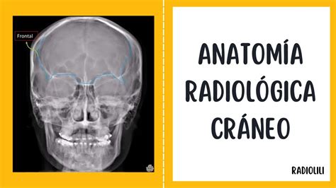 Anatomía Radiológica Radiología Convencional Cráneo Proyecciones
