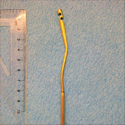 How to check iud strings. IUD String Perforation Through Anterior Cervix: A Case ...