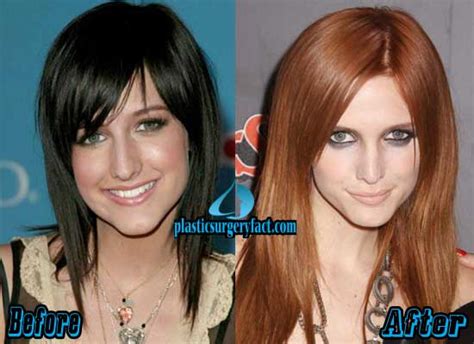 Ashlee Simpson Plastic Surgery Before And After Photos Plastic