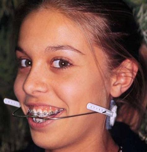 Braces Girls Teeth Braces Headgear Predator Teen Girl Future Low