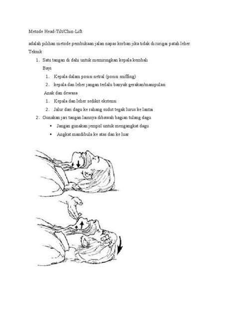 From wikipedia, the free encyclopedia. Metode Head Tilt-Chin Lift Dan Jaw Thrust