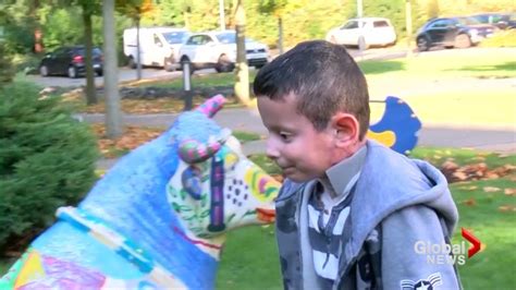 ‘butterfly Boy Saved From Debilitating Illness After Doctors Create