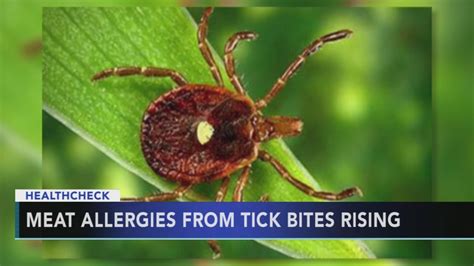 Lone Star Tick That Triggers Red Meat Allergy Spreading Across Us
