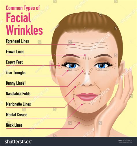Common Types Facial Wrinkles Cosmetic Surgery Stock Vector Royalty Free 635549162 Shutterstock