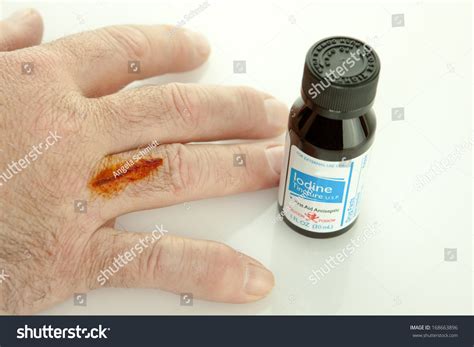 Finger Cut Iodine Treatment On Bottle Stock Photo Shutterstock