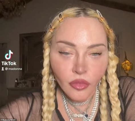 Madonna Fans Grow Concerned Over The Stars Unsettling Appearance