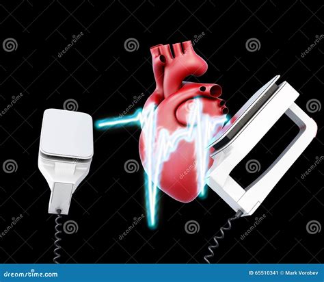 Defibrillator And Heart On A Black Background Stock Illustration
