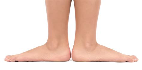 How Do Flat Feet Affect Your Overall Health