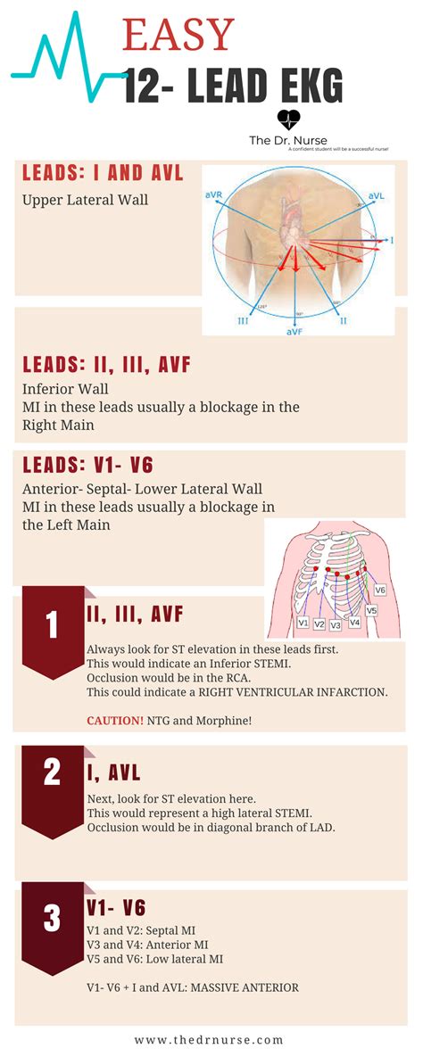 Best Way To Learn 12 Lead Ecg Just For Guide