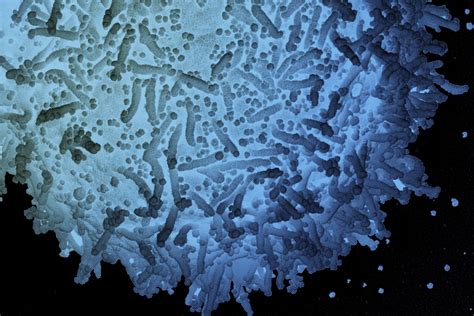 Coronavirus Will Resemble The Common Cold Scientists Predict The New