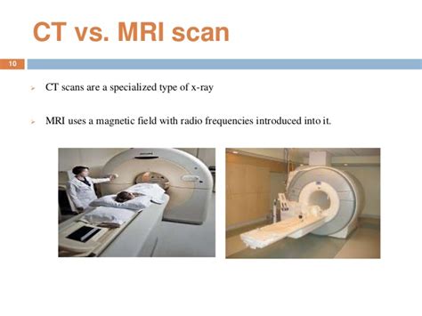 There is no radiation hazard risk for the patients undergoing an mri scan. Intelligent computer aided diagnosis system for liver fibrosis