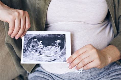 Manos De Mujer Embarazada I Ropa Informal Sosteniendo La Foto De Su