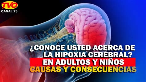 ¿conoce Usted Acerca De La Hipoxia Cerebral En Adultos Y Niños Causas